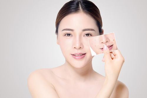 芜湖美容短期培训
